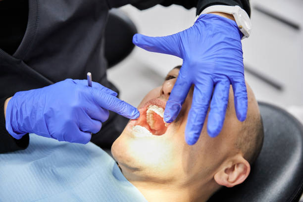 Best Knocked-Out Tooth Emergency  in Lynnville, IN
